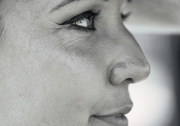 A Dermatologists Guide: People Should Follow These Tips To Prevent Wrinkles 